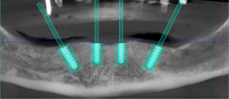 Sergio Cortes Aroche-4