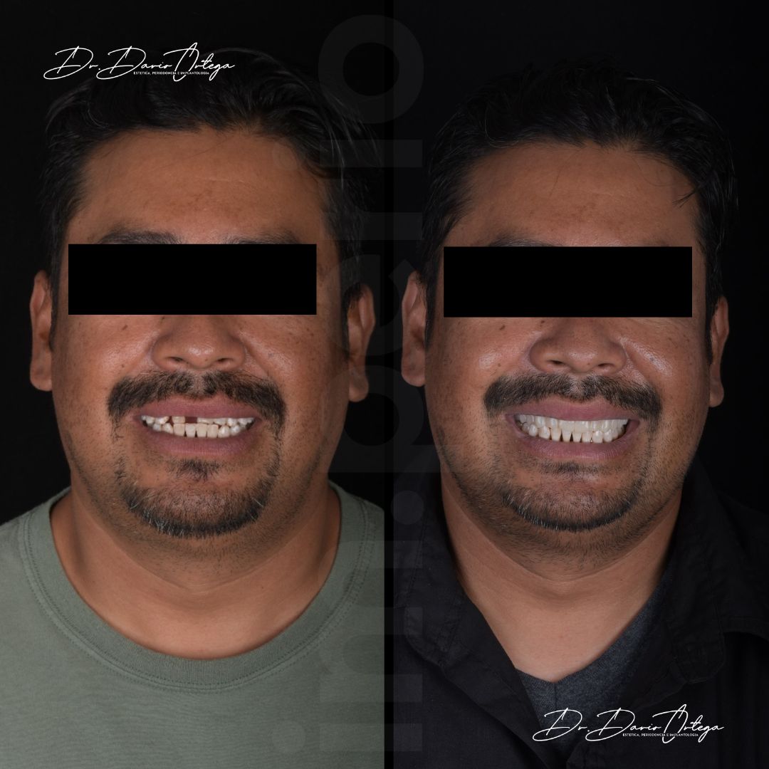 Dario Ortega Aceves-7