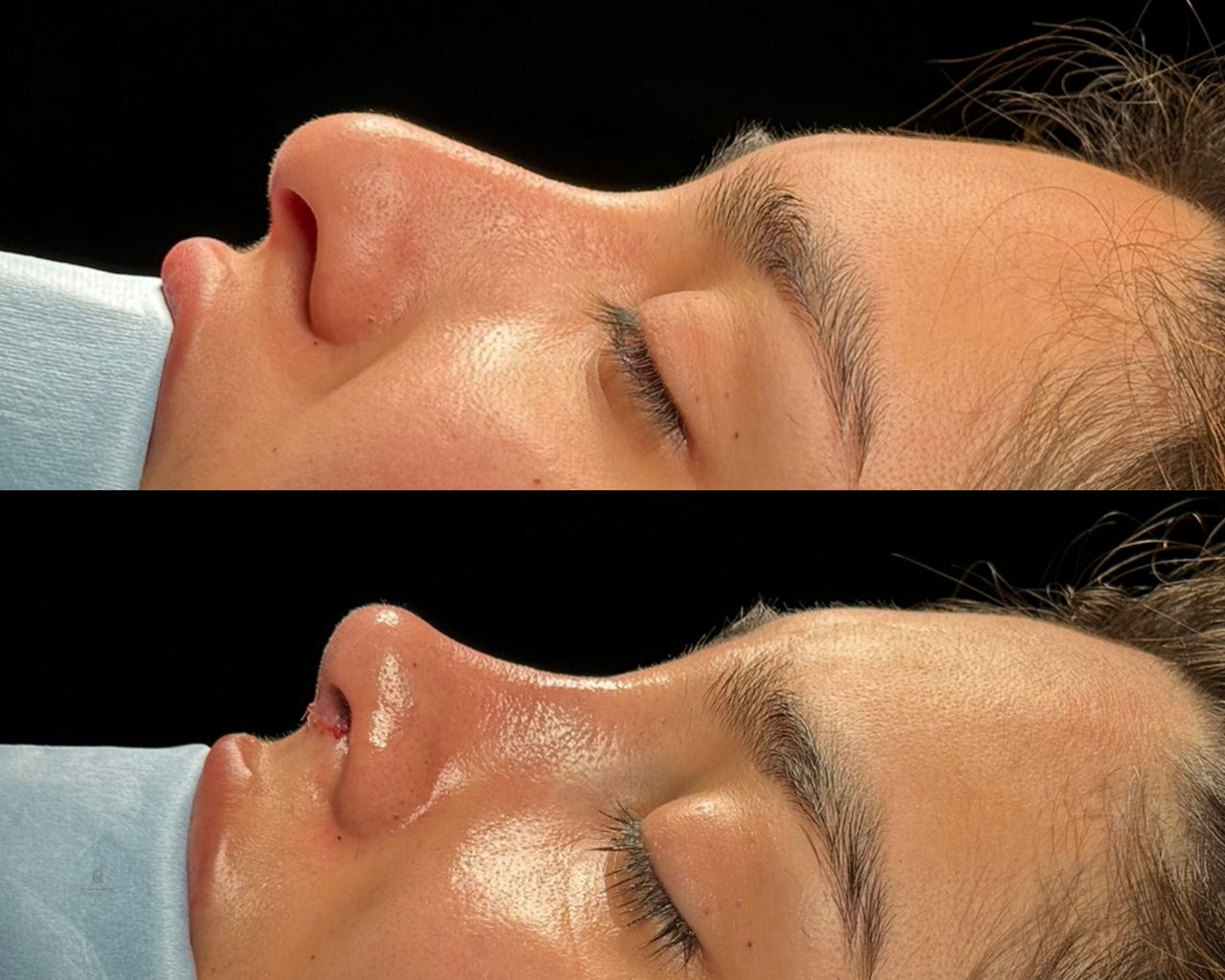 Angel Castro Urquizo-67