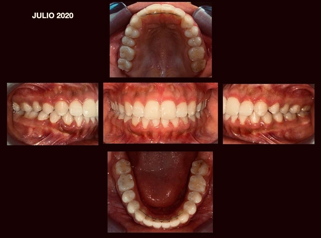 Zuriel Ayala Garcia-9