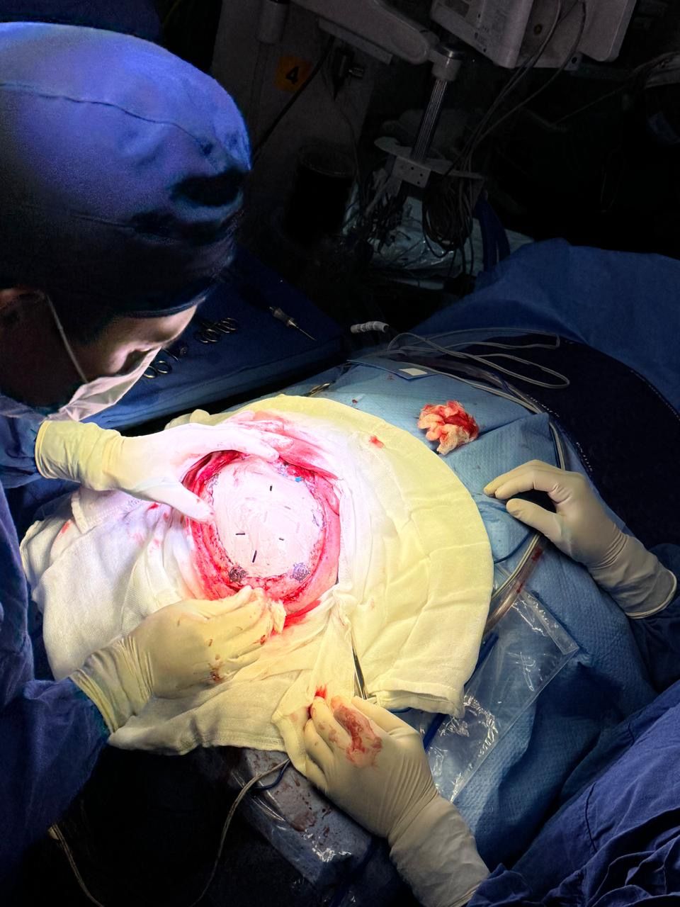 Juan Antonio Alvaro Heredia-8