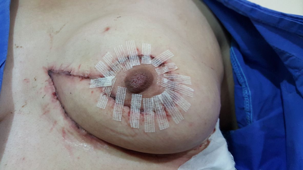 Ángel Millán Juárez-61