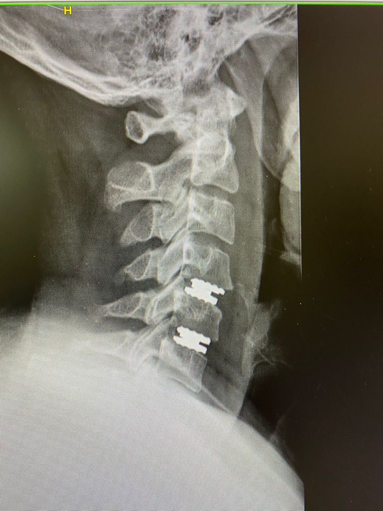 Rodolfo Pérez Ramos-8