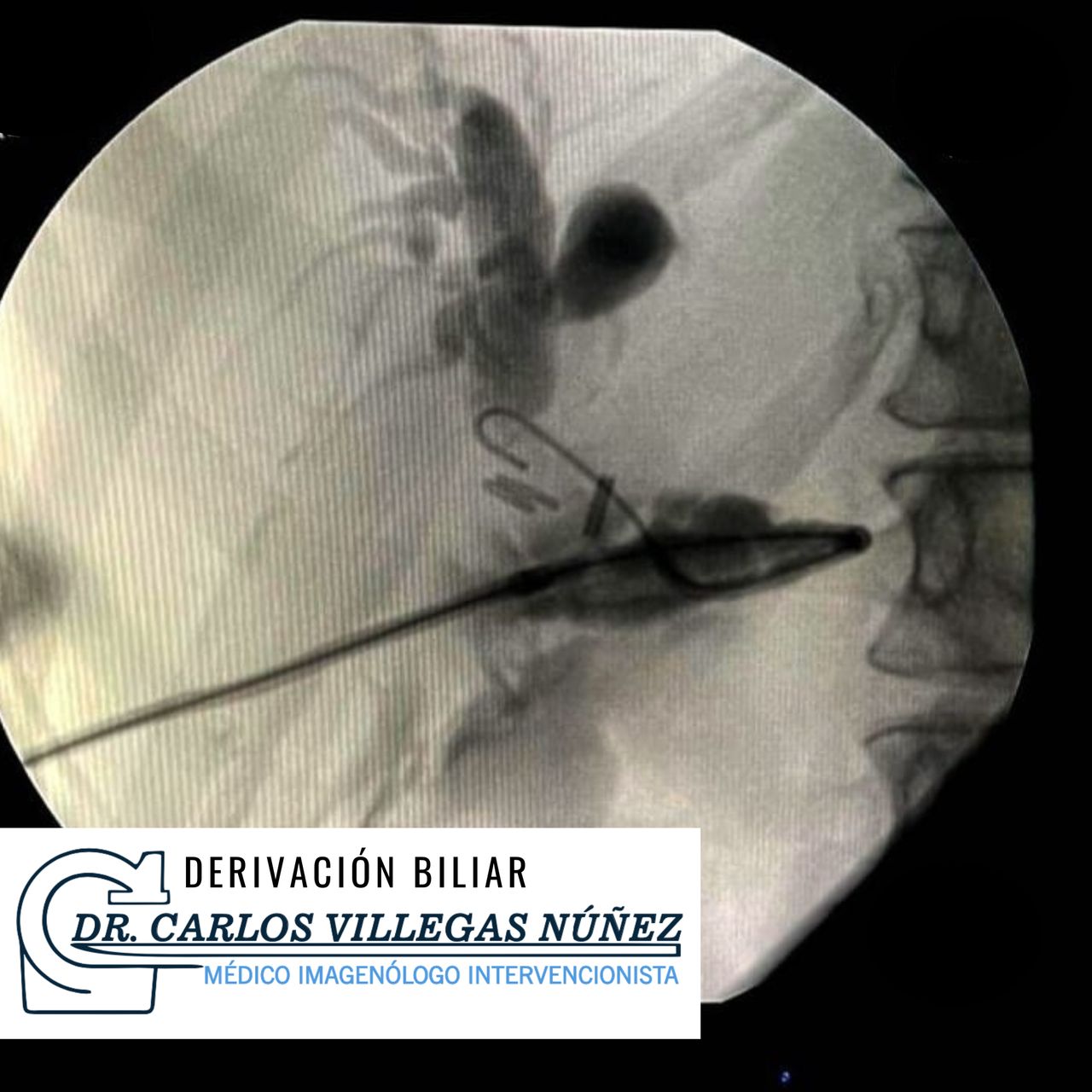 Carlos Enrique Villegas Nuñez-3