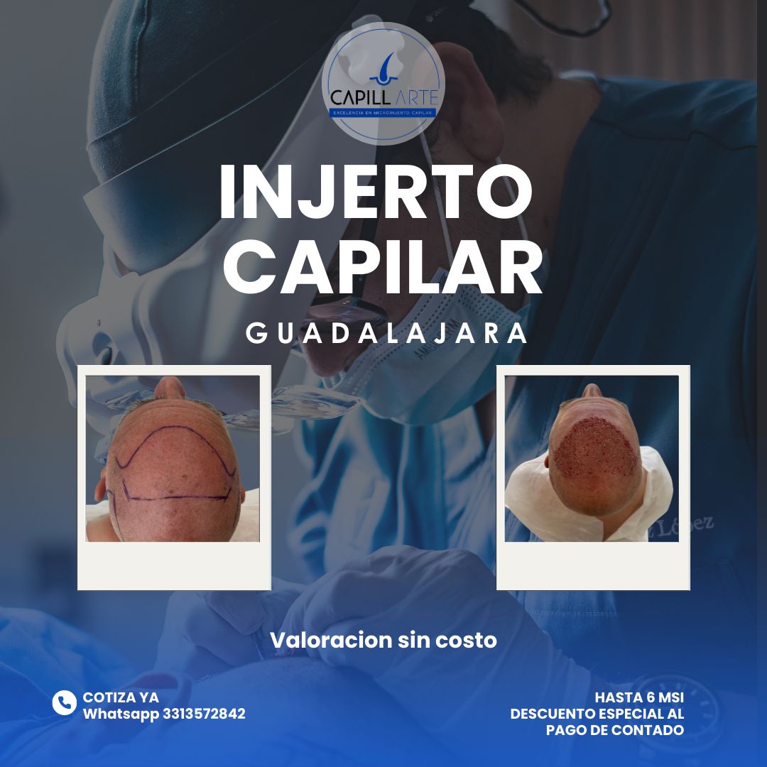 Adrian Hernandez Lopez-28