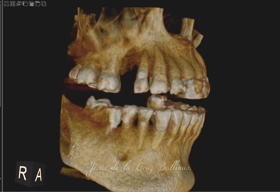 Jesus De La Cruz Ballinas-14