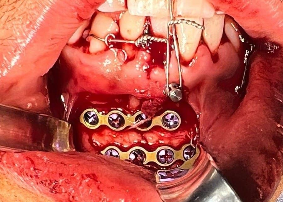 Carlos Ernesto Contreras Castellanos-44