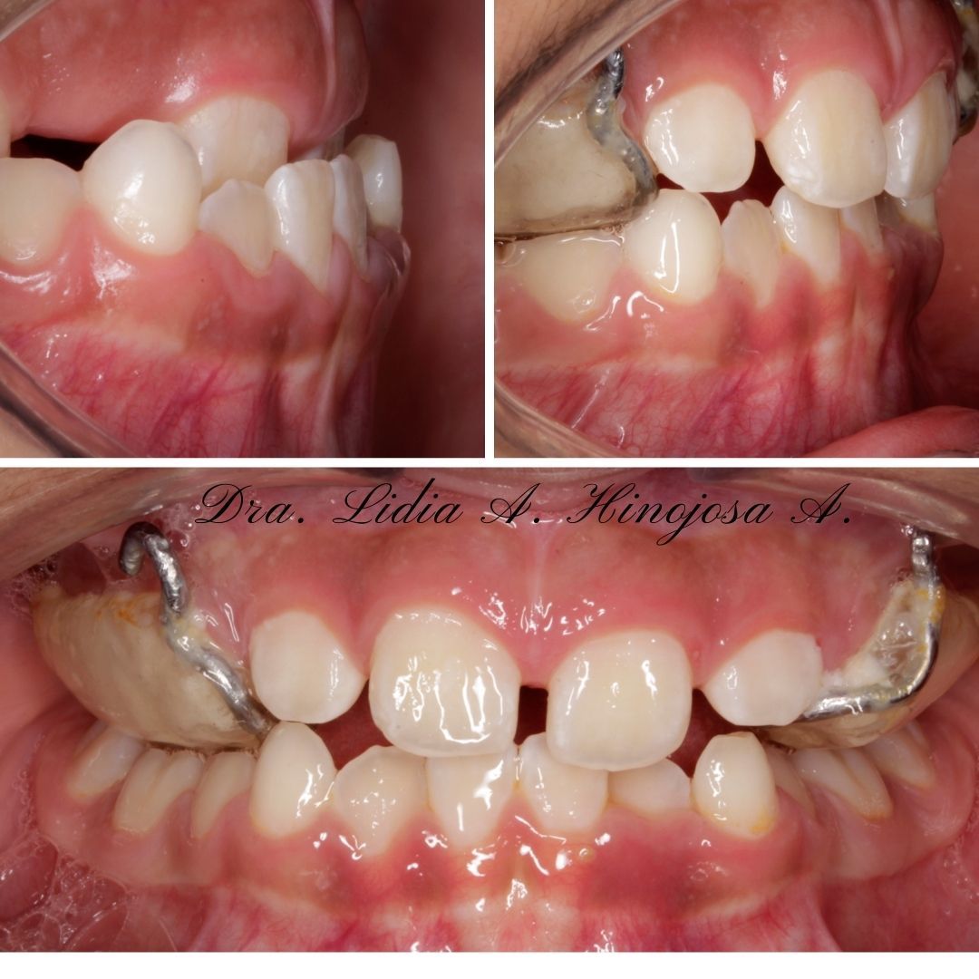 Lidia Abigail Hinojosa Arellanes-32