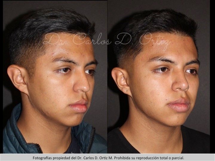 Carlos David Ortiz Moreno-37