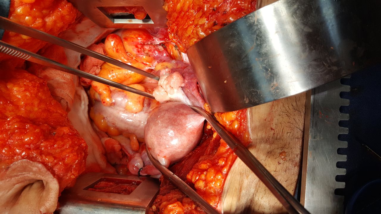 Ángel Millán Juárez-37