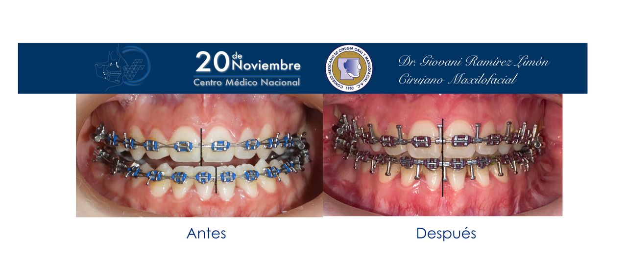 Giovani Ramírez Limón-30