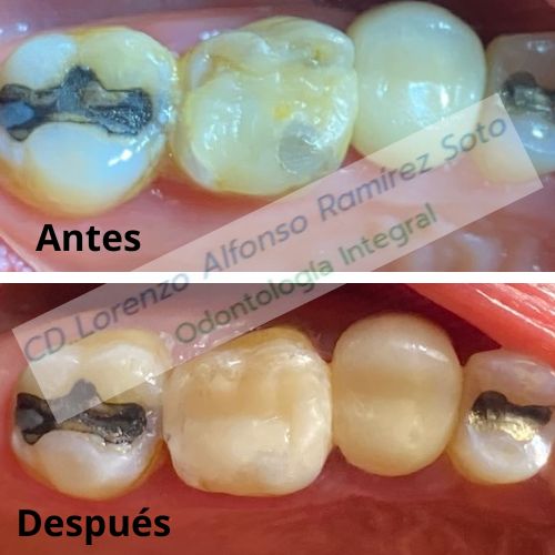 Lorenzo Alfonso Ramìrez Soto-0