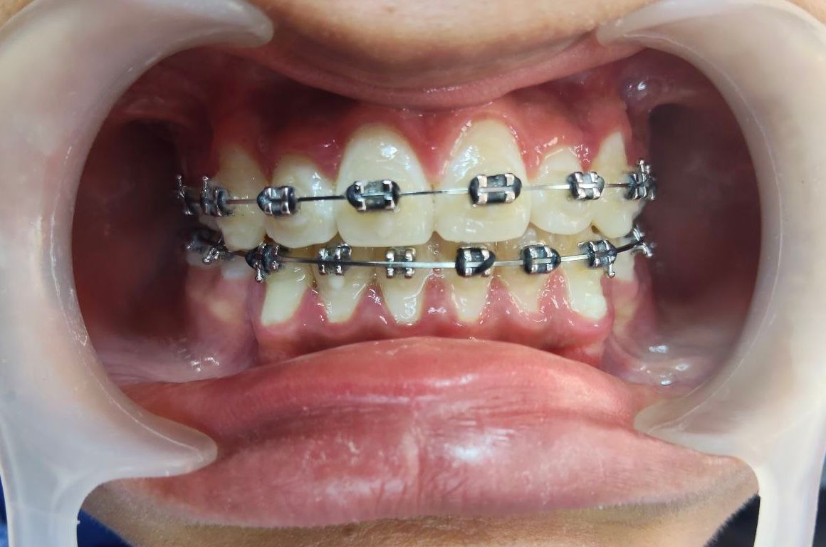 Melina Belmont Aguilar-2