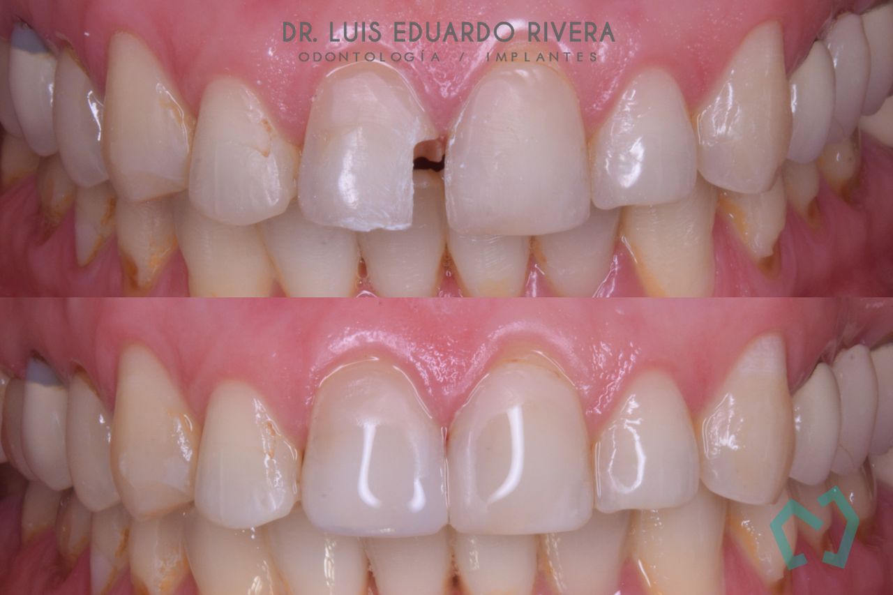 Luis Eduardo Rivera-51
