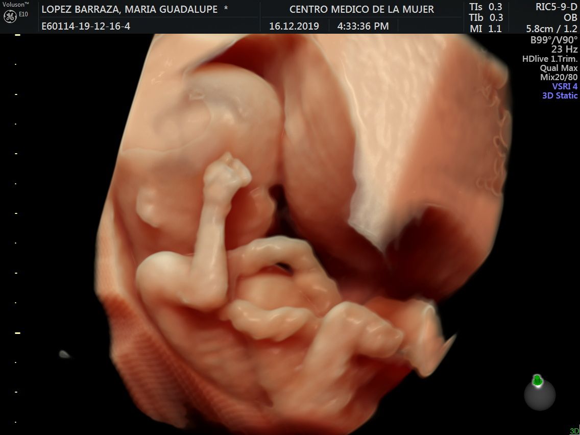 Julio Cesar Monárrez Martín-19