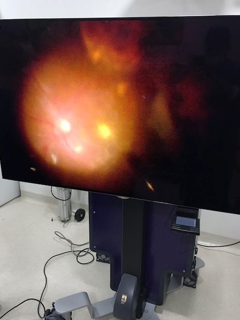 Alain Matabuena D.-7