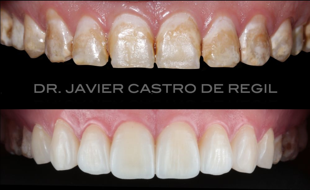 Javier Castro De Regil-1