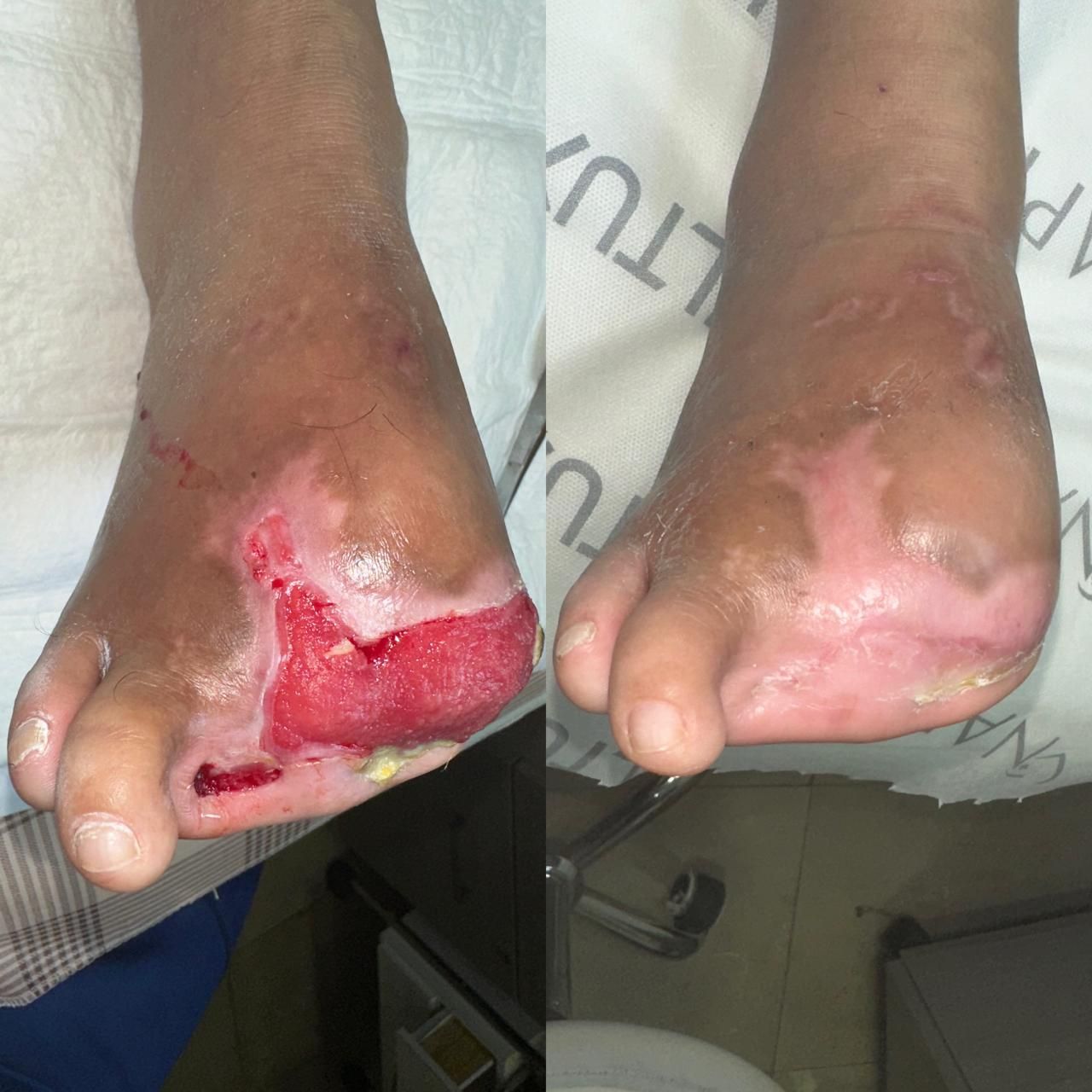 Jhonatan López González-30