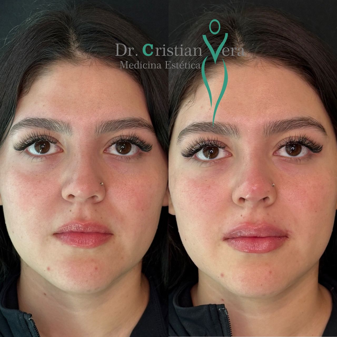 Cristian Eduardo Vera Nuño-3