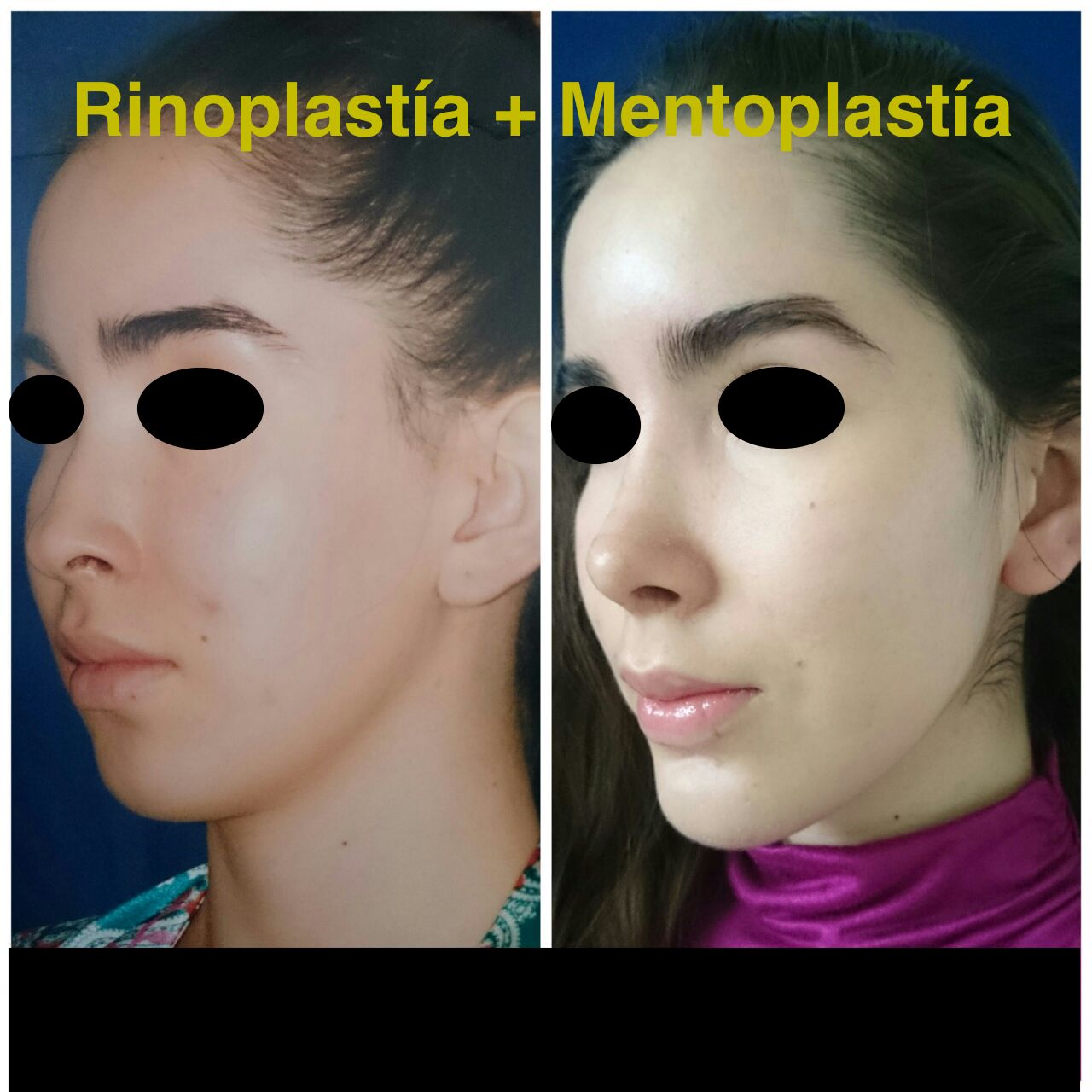 Ubaldo Carpinteyro Espín-7