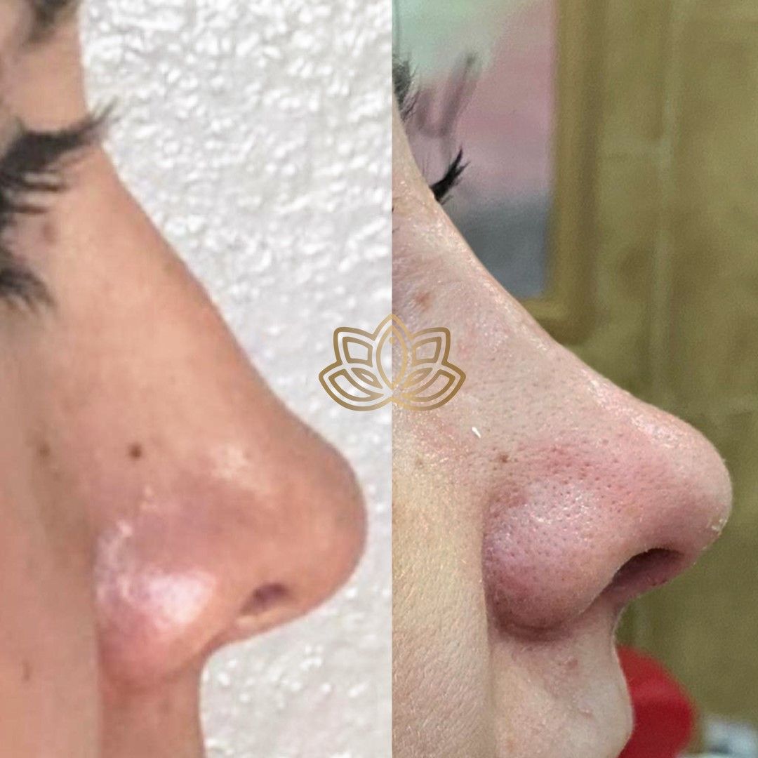 Dario Alfredo Cadenas Ruvalcaba-6