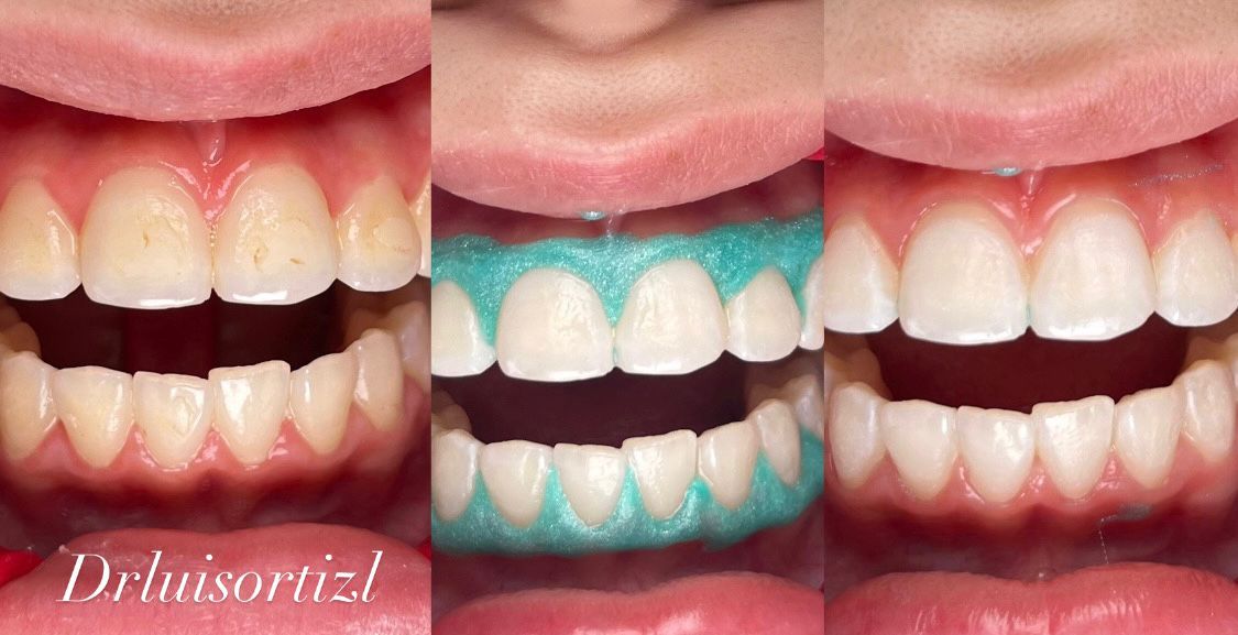 Luis Ángel Ortiz López-35