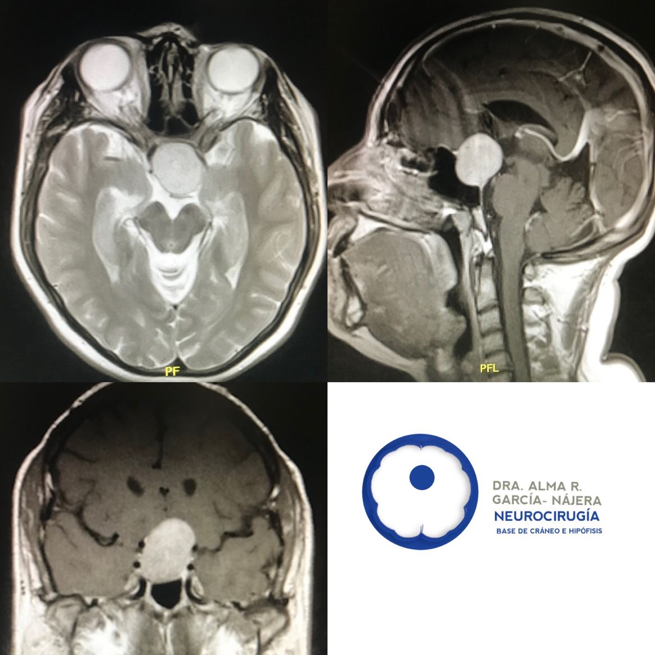 Alma García Nájera-16