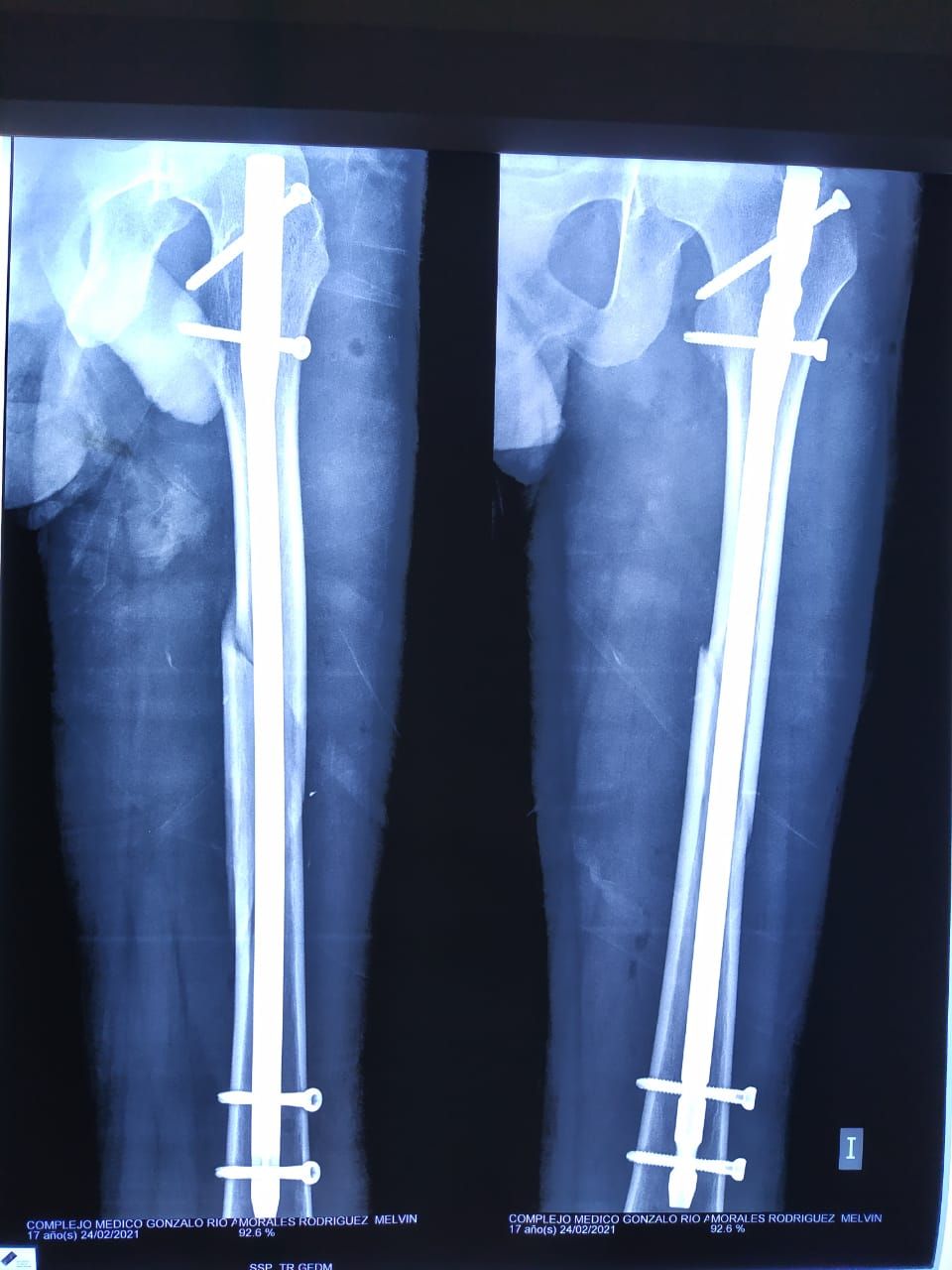 Juan Miguel Vargas Martínez-3