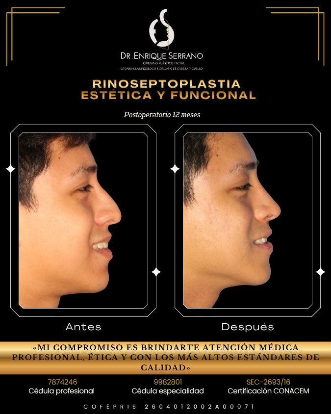 Enrique Serrano Cruz-3