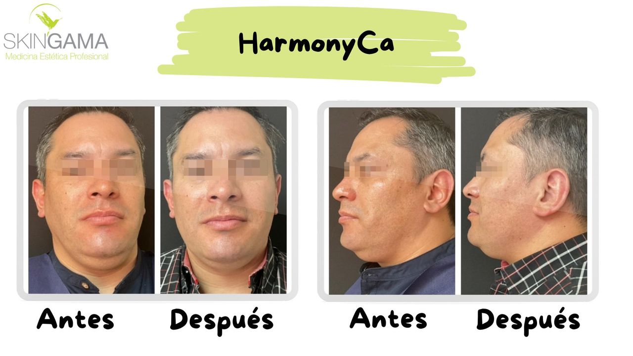 Juan Herrera Hernández-53