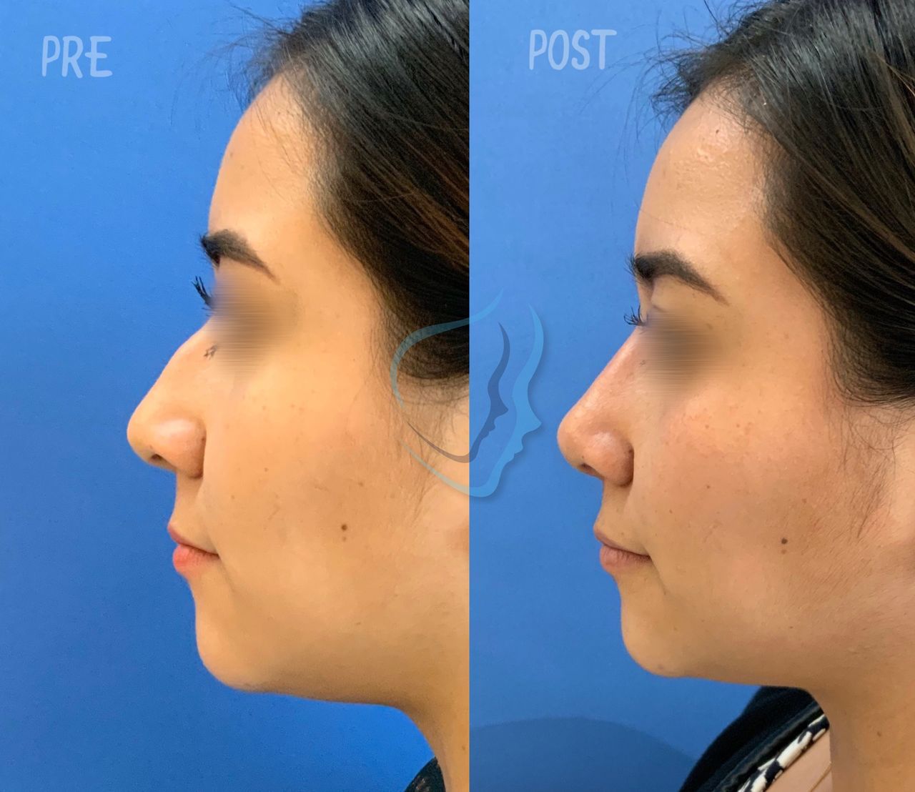 Giuseppe Tanzillo-74