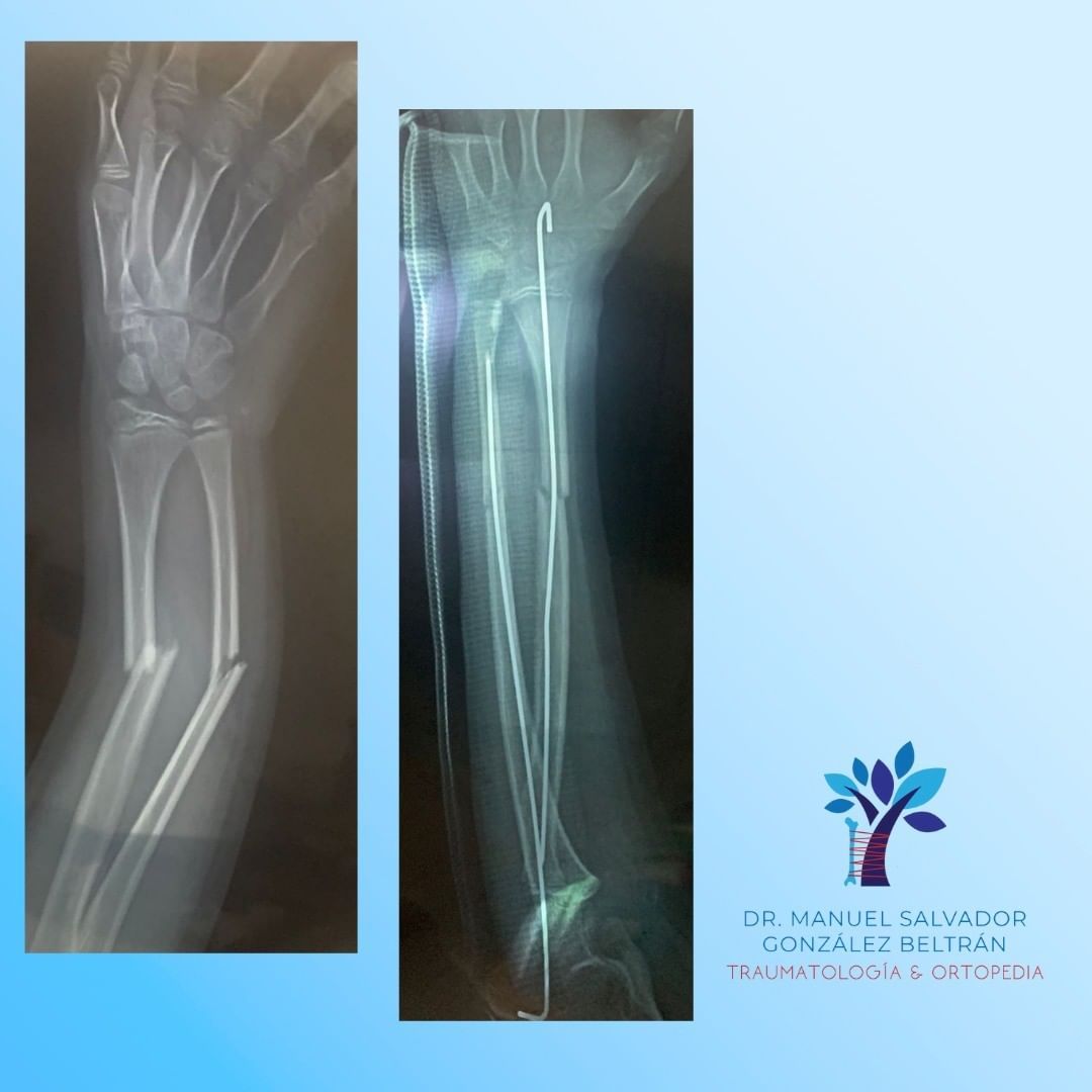 Manuel Salvador Gonzalez Beltran-6