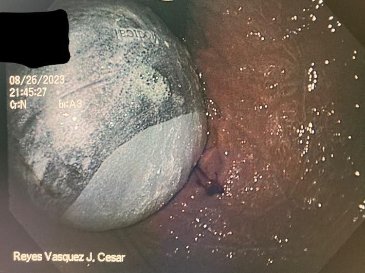 J. César Reyes Vásquez-23