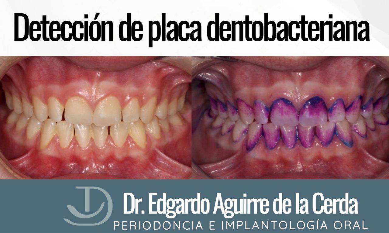 Edgardo Aguirre De La Cerda-8