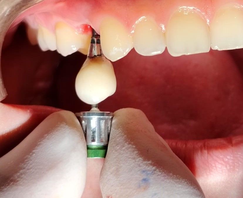 Fernando Fuentes Lozada-14