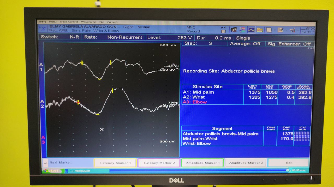 Lizeth Patricia Mena Rivas-39