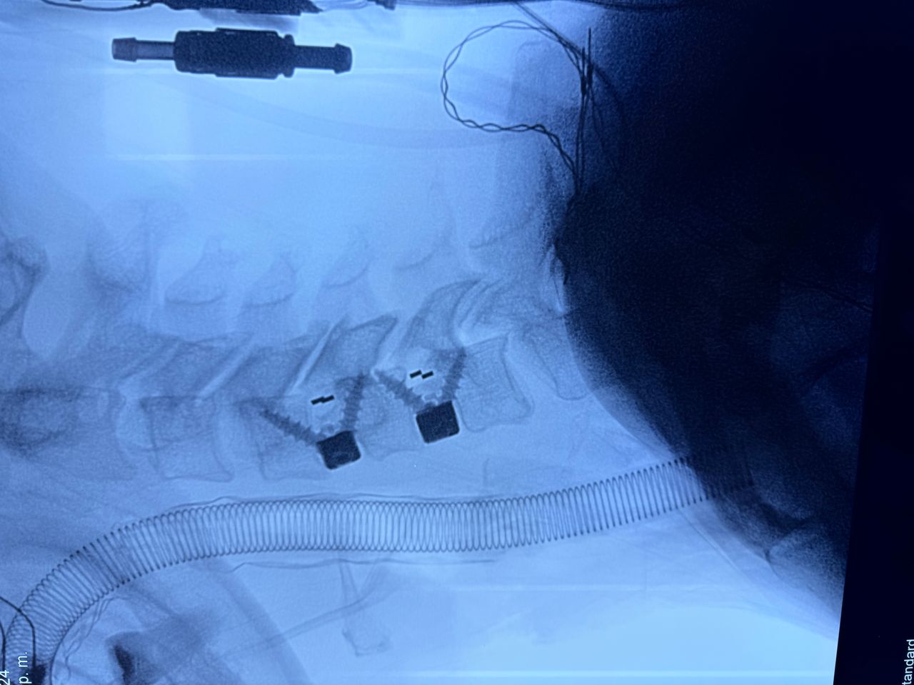 Manuel De Jesús Ambrosio Vicente-2