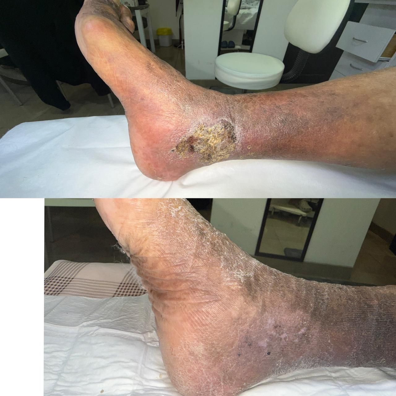 Jhonatan López González-73