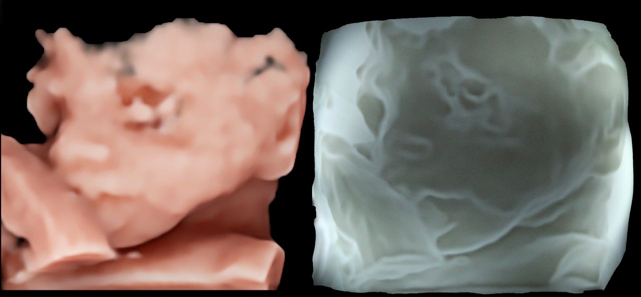 Raul Alejandro Patlan Montalvo-5