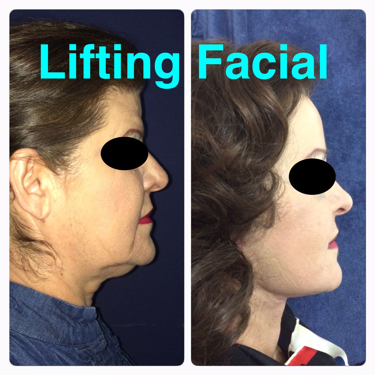 Ubaldo Carpinteyro Espín-6