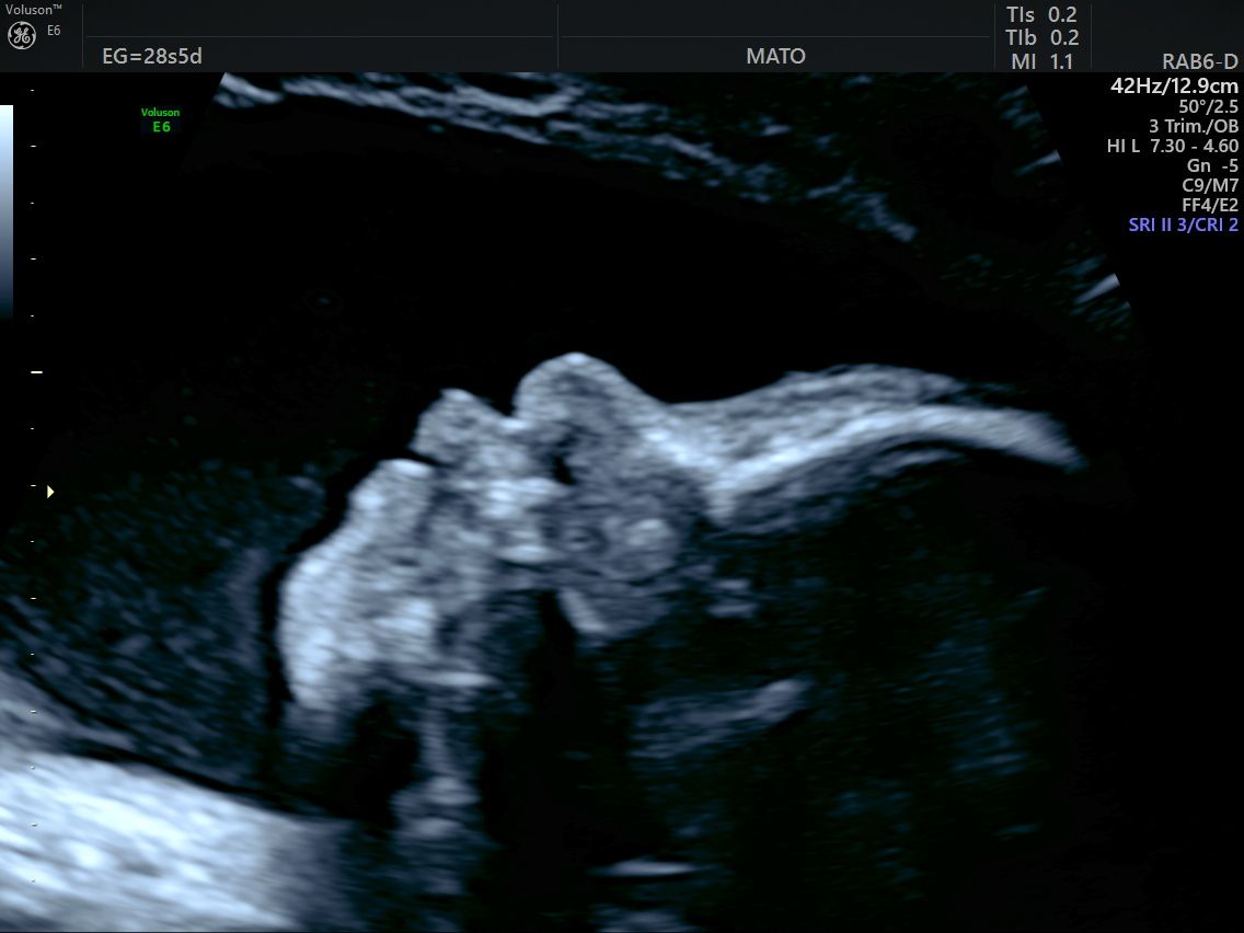 Guillermo Abrego Rodríguez-7