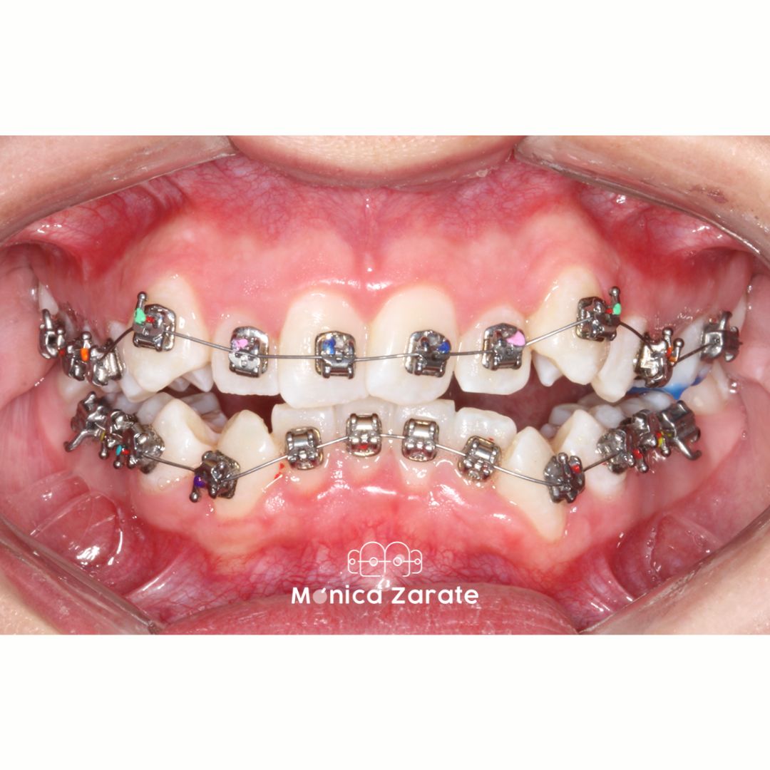 Mónica Isabel Zárate Pérez-16