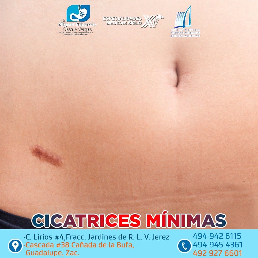 Miguel Eduardo Casale Vargas-12