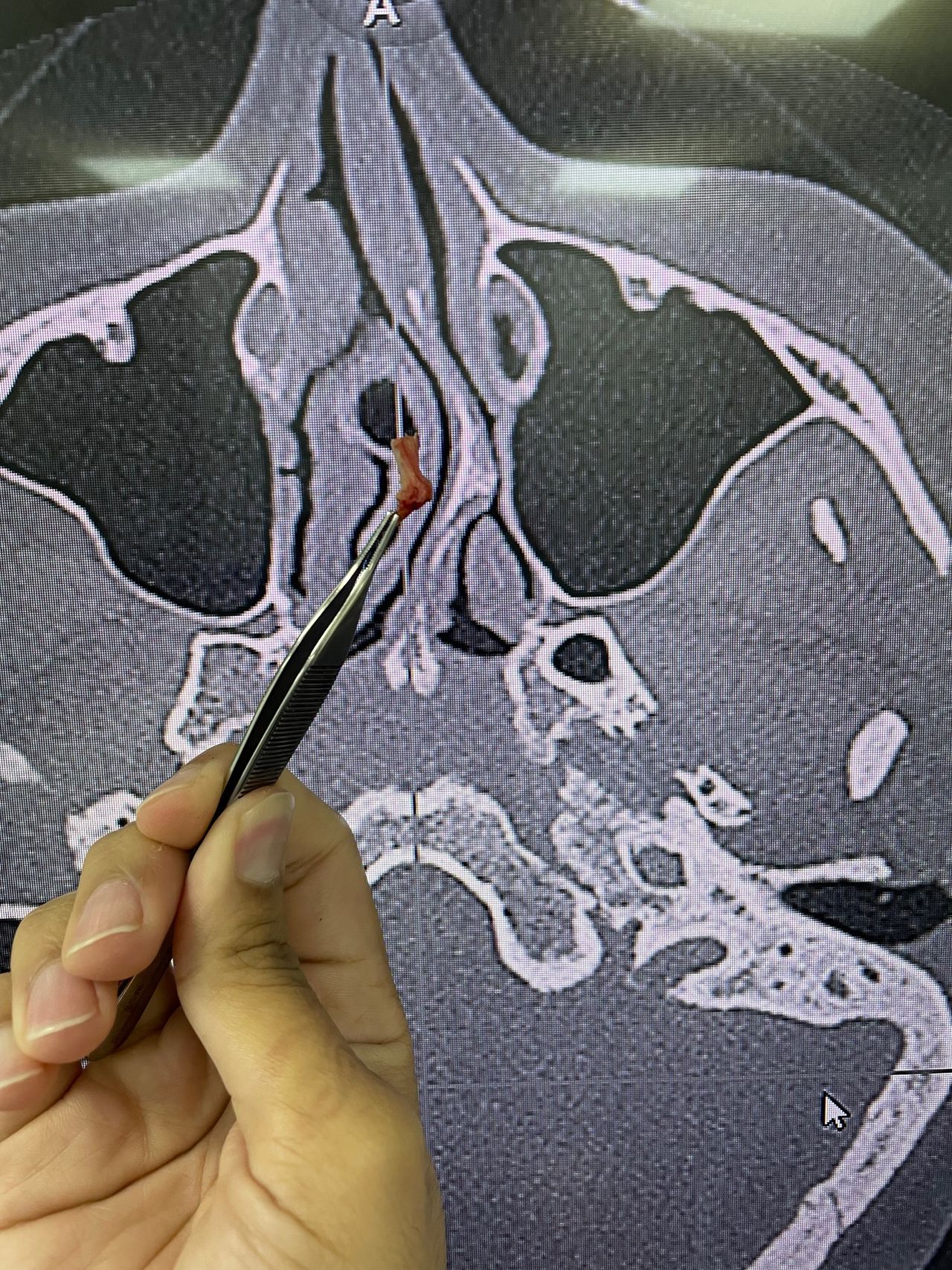 Martin Alberto Hernandez Cardenas-2