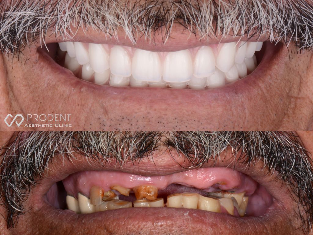 Ramiro Ivan Pérez Murillo-10