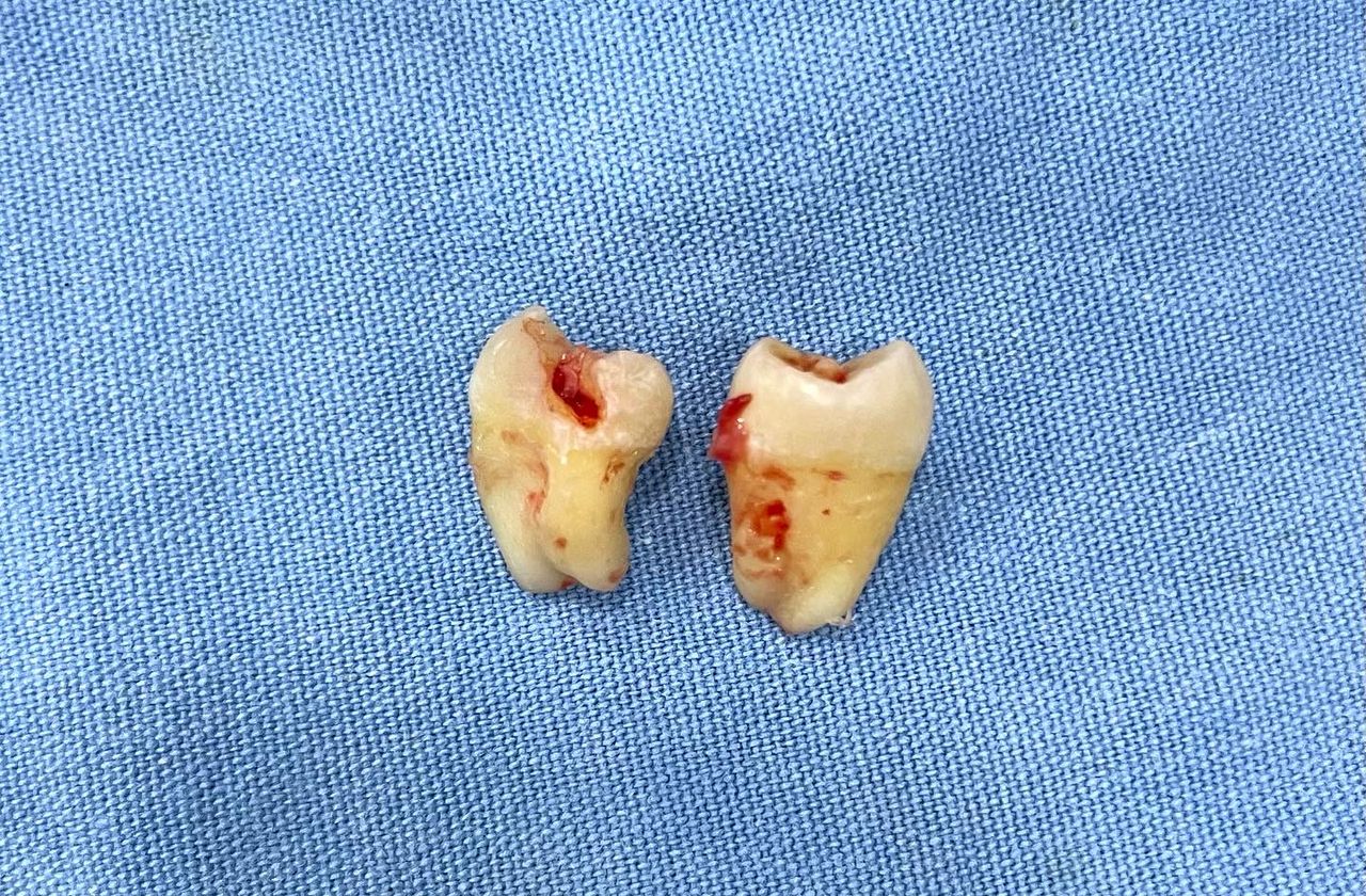 Alejandro Angelo López Díaz-17