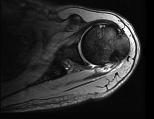 Juan Antonio Benitez-10