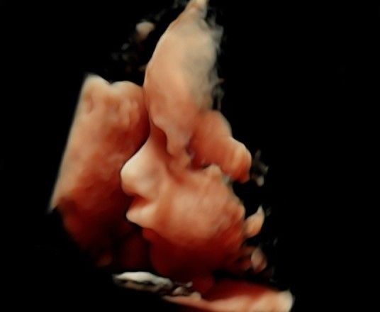 Miguel Angel González Nazar-7