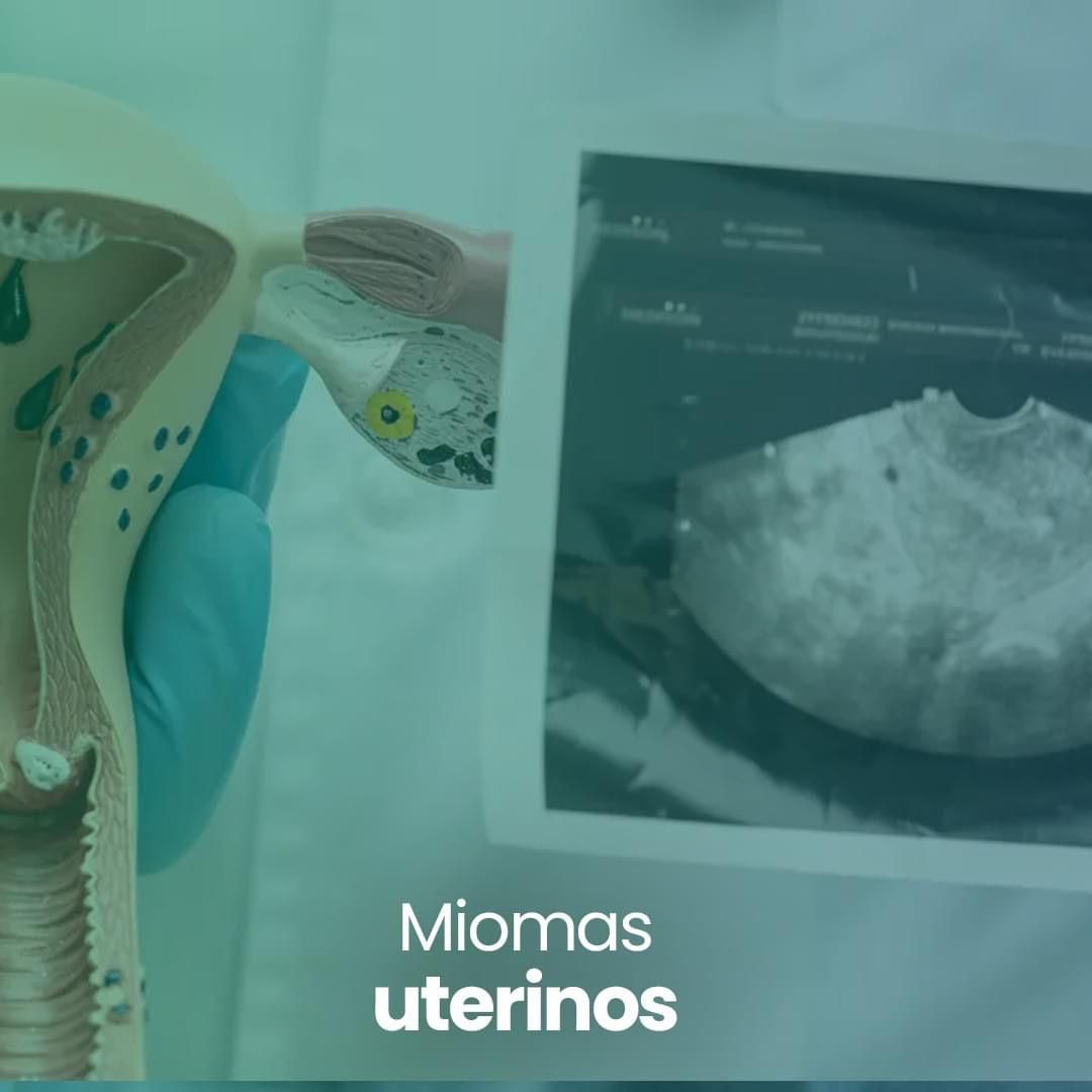 Gonzalo Hernández Martínez-83