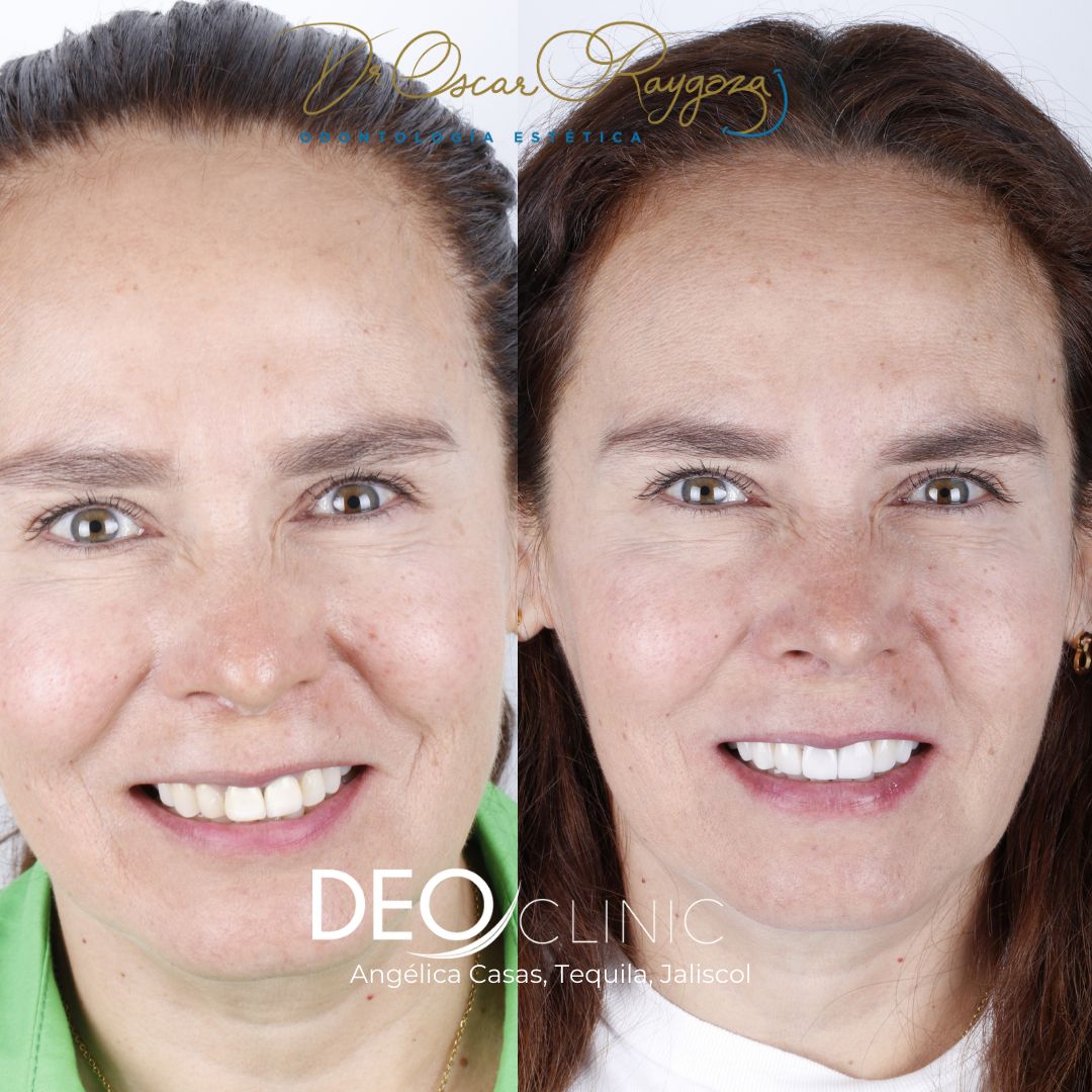 Oscar Raygoza Carrillo-47